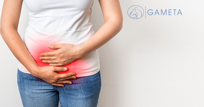 Endometrioza a ciąża